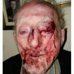 Pensionar de 87 de ani din Birmigham desfigurat în bătaie de hoața care i-a intrat în casă
